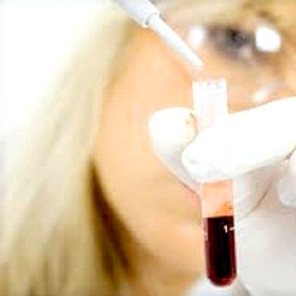 Як знизити рівень кортизолу: підвищений кортизол